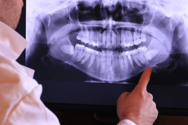 Best Emergency Cosmetic Dentistry (e.g., broken veneers) in Arlington, GA