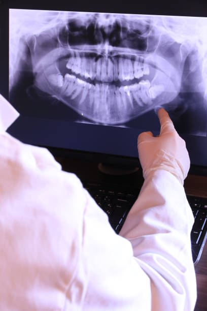 Best Dental Abscess Treatment in Arlington, GA